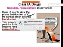 Anti arrhythmic drugs classification and their clinic use with side effects