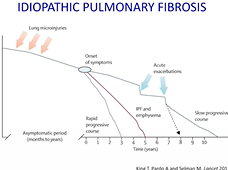 Anti Fibrotic Therapies in Idiopathic Pulmonary Fibrosis