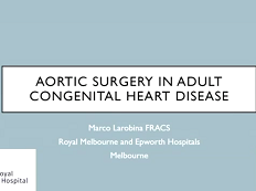 Aortic surgery in adult congenital heart disease