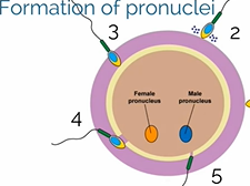 APGO Basic Sciences - Topic 19: Gestational Trophoblastic Disease