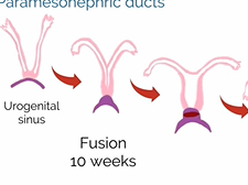 APGO Basic Sciences - Topic 20: Mullerian Anomalies