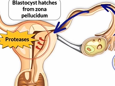 APGO Basic Sciences - Topic 21: Multiple Gestation Pregnancies