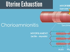 APGO Basic Sciences - Topic 30: Uterine Atony