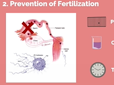 APGO Basic Sciences - Topic 6: Contraception