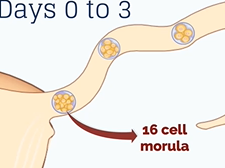 APGO Basic Sciences - Topic 9: Ectopic Pregnancy