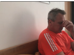 Apomorphine-Induced Yawning and Sleep Attacks Apomorphine-Induced Yawning and Sleep Attacks