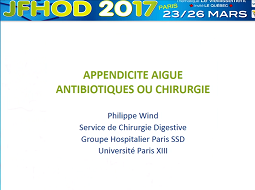 Appendicite aiguë : antibiotiques ou chirurgie