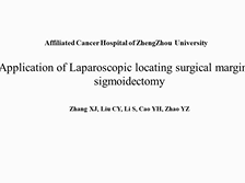 Application of Laparoscopic locating surgical margin in sigmoidectomy a video vignette Application of Laparoscopic locating surgical margin in sigmoidectomy a video vignette