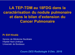 Applications cliniques 1 - Extension tumorale initiale et planification en radiothérapie Applications cliniques 1 - Extension tumorale initiale et planification en radiothérapie
