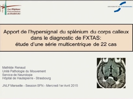Apport de l'hypersignal du splénium du corps calleux dans le diagnostic du syndrome tremblement ataxie lie a la premutation de l'X Fragile