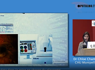 Apport du Big Data dans la prise en charge du Glaucome