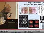 Apport du séquençage haut débit dans le diagnostic et traitement des histiocytoses Apport du séquençage haut débit dans le diagnostic et traitement des histiocytoses