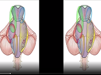 Approaches to the Brainstem (3D) Approaches to the Brainstem (3D)