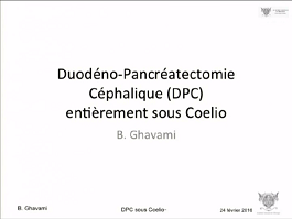 Approche totalement laparoscopique de la duodeno-pancréatectomie céphalique (DPC). Description de la technique