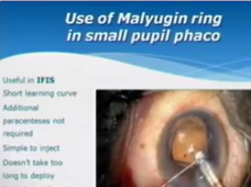 Archive of Webinar By Dr Rajiv Choudhary