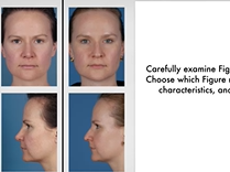 Are You Known for Your Nose? Plastic Surgery Hot Topics with Rod J. Rohrich, MD Are You Known for Your Nose? Plastic Surgery Hot Topics with Rod J. Rohrich, MD