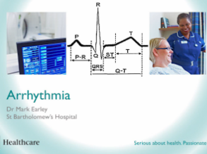 Arrhythmia