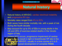 Arrhythmogenic right ventricular dysplasia