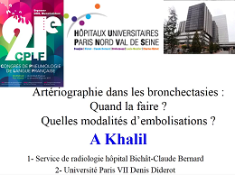 Artériographie dans les bronchectasies: quand la faire? Quelles modalités d'embolisations? Artériographie dans les bronchectasies: quand la faire? Quelles modalités d'embolisations?