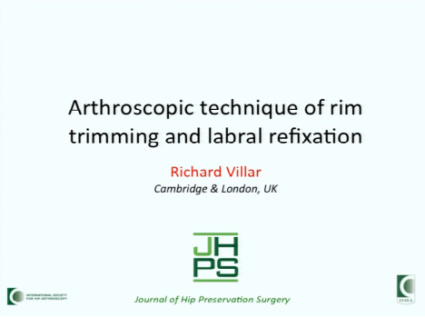 Arthroscopic technique of rim trimming and labrum refixation