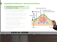 Atherosclerosis: Pathogenesis & Supply/Demand Mismatch Atherosclerosis: Pathogenesis & Supply/Demand Mismatch