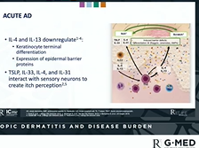 Atopic Dermatitis and disease burden