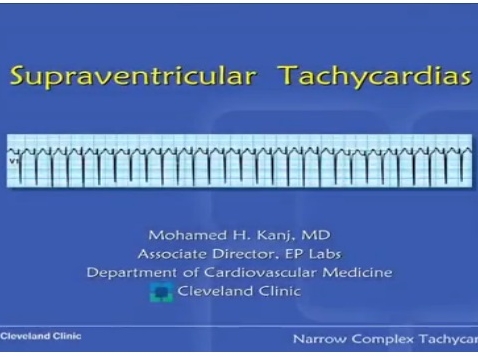 Atrial Fibrillation and Other Supra Ventricular Tachycardias