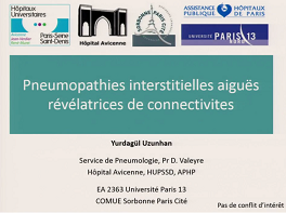 Atteinte pulmonaire aiguë révélatrice des connectivites