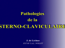 Atteinte sterno-claviculaire : prise en charge Atteinte sterno-claviculaire : prise en charge