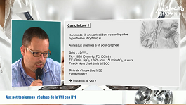 Aux petits oignons : réglages de la VNI cas N°1