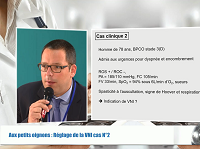 Aux petits oignons : réglages de la VNI cas N°2