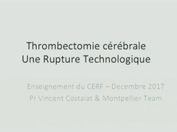 Avancée en thrombectomie intracérébrale
