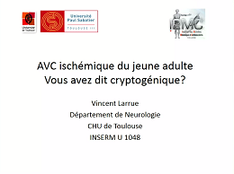 AVC ischemique du jeune adulte : vous avez dit cryptogenique ? AVC ischemique du jeune adulte : vous avez dit cryptogenique ?