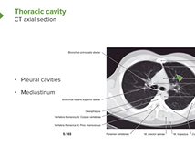Axial Section of the Thoracic Cavity - Anatomy Axial Section of the Thoracic Cavity - Anatomy
