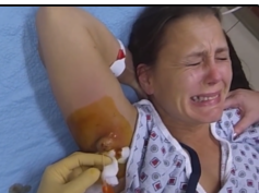 Medflixs - Abscesses, Abscess Removal, Drainage and More! by DrER