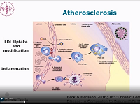 Back Arteriosclerosis, statins and stroke prevention