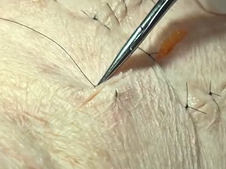 Basic surgical technique