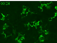 Behavior of Langerhan Cells Under Pathological Conditions