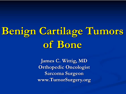 Benign Cartilage Tumors (Osteochondroma, Chondroblastoma)