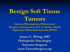 Benign Soft Tissue Tumors