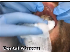 Best of Ingrown Nails, Dental Abscesses & the Emergency Room!