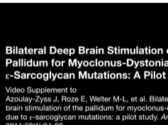 Bilateral Deep Brain Stimulation of the Pallidum for Myoclonus-Dystonia Due to ?-Sarcoglycan Mutatio-2 Bilateral Deep Brain Stimulation of the Pallidum for Myoclonus-Dystonia Due to ?-Sarcoglycan Mutatio-2