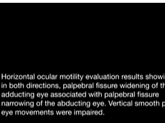 Bilateral Symmetrical Acquired Third Nerve Synkinesis Bilateral Symmetrical Acquired Third Nerve Synkinesis
