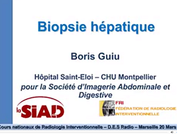 Biopsie hépatique Biopsie hépatique