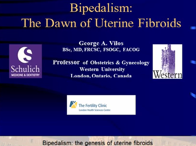 Bipedalism: the genesis of uterine fibroids Bipedalism: the genesis of uterine fibroids