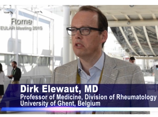 Birth characteristics and childhood infections predict ankylosing spondylitis Birth characteristics and childhood infections predict ankylosing spondylitis