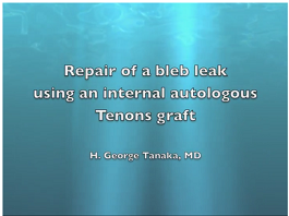 Bleb Leak Repair Using an Internal Autologous Tenon Graft Bleb Leak Repair Using an Internal Autologous Tenon Graft