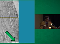 Bowman Layer Transplantation