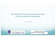 Branched and fenestrated endovascular repair of thoraco-abdominal pathologies Branched and fenestrated endovascular repair of thoraco-abdominal pathologies