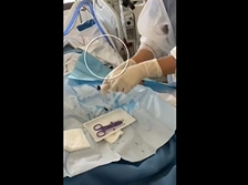 Branchement et débranchement d'un circuit d'épuration extra rénale sur un cathéter de dialyse